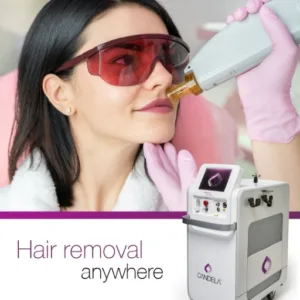 extra small area laser hair removal